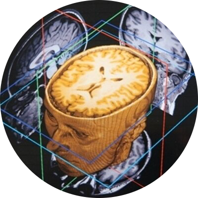 A image of a brain cut in half
